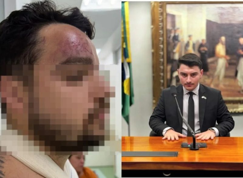 Assessor de Jair Renan investigado por agredir primo após vitória de Lula pede exoneração do cargo