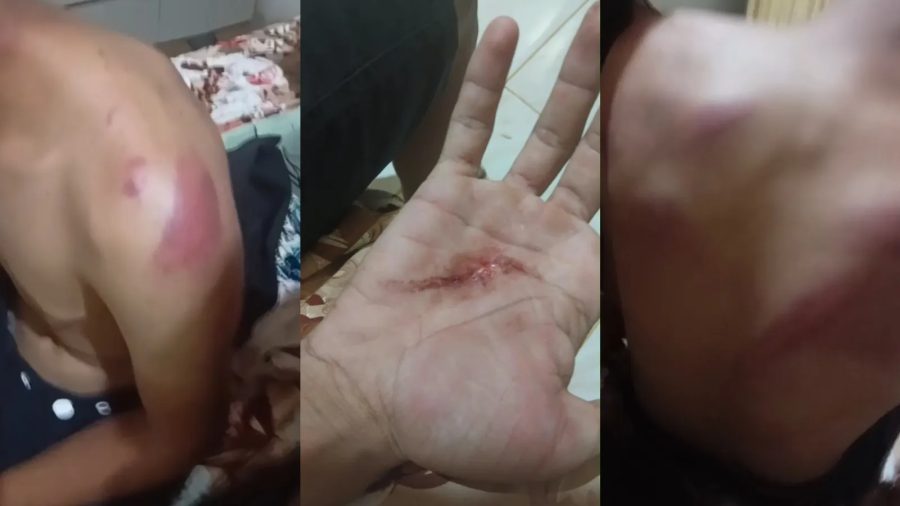 Jovem é denunciado por tortura policial em Capistrano, Ceará