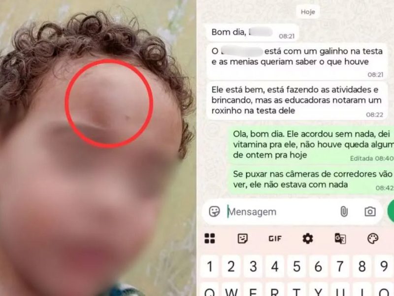 Criança de 2 anos volta de creche com hematoma no rosto em SP