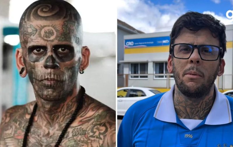 ‘Mais tatuado do Brasil’ passa pela 1ª sessão de quimioterapia para tratar câncer na bexiga: ‘Me sinto muito bem’