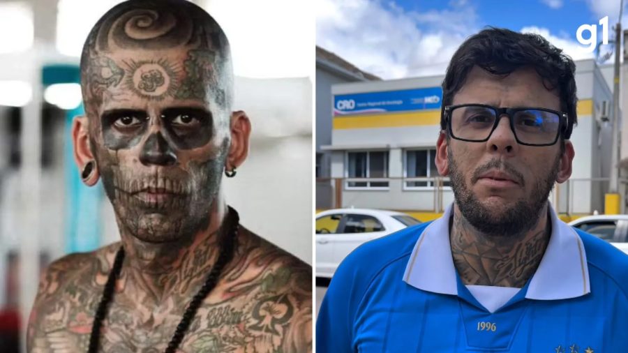 'Mais tatuado do Brasil' passa pela 1ª sessão de quimioterapia para tratar câncer na bexiga: 'Me sinto muito bem'