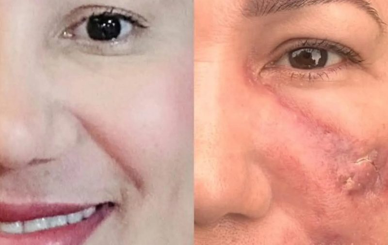 Falsa médica presa no Amapá deixa vítima com deformidade facial