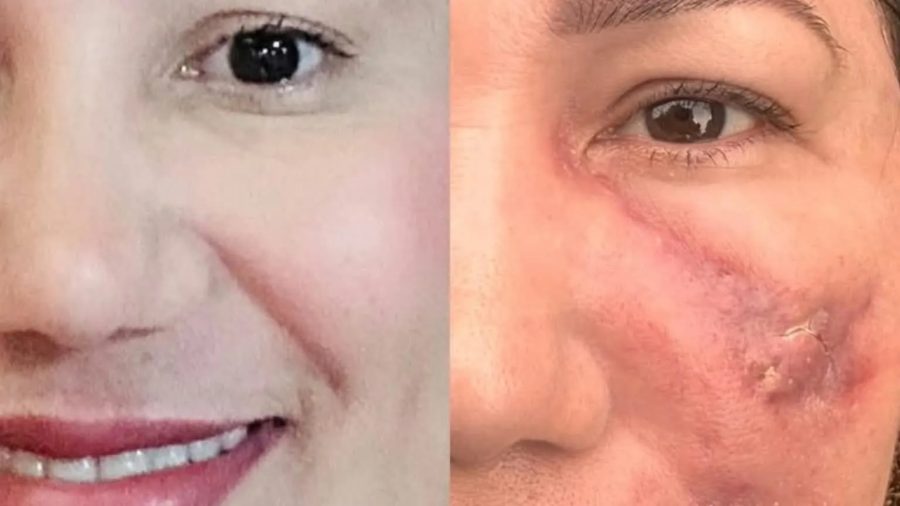 'Não me reconheço': vítima relata como procedimento estético terminou em deformidade facial no Amapá