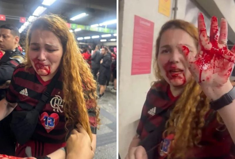 Passageira é agredida no rosto com cassetete por funcionária do MetrôRio durante confusão de torcedores após o jogo do Flamengo