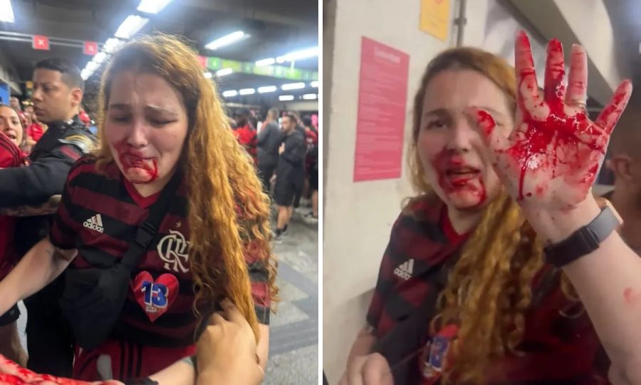 Passageira é agredida no rosto com cassetete por funcionária do MetrôRio durante confusão de torcedores após o jogo do Flamengo
